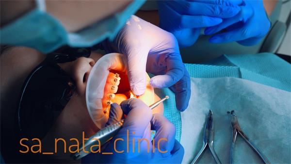 Срок ношения брекетов у детей и подростков