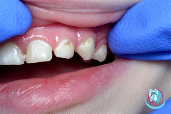 детская стоматология