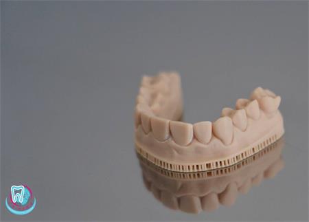 Как происходит сканирование с помощью сканера 3Shape? 