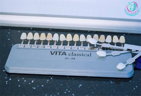 Современные методы отбеливания зубов 