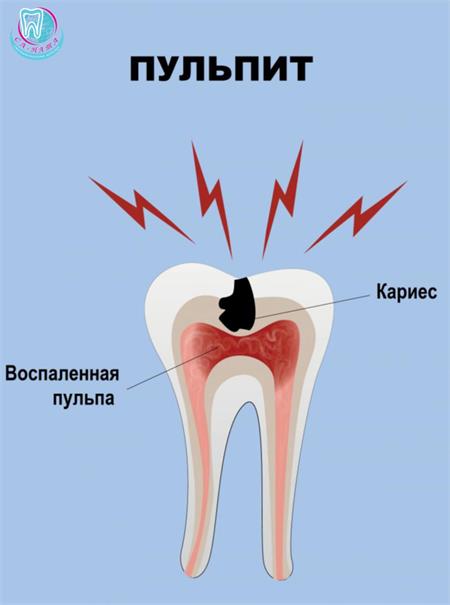 Как происходит воспаление?