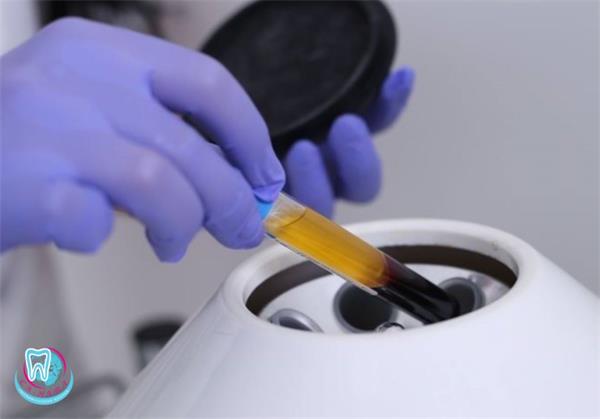 рецессия десны