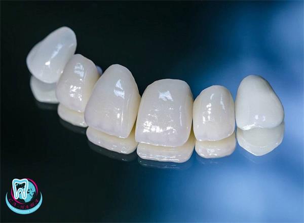 Ортопедические коронки из диоксида циркония