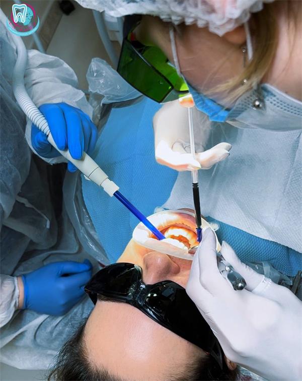 Этапы фотодинамотерапии десен могут включать следующие: 