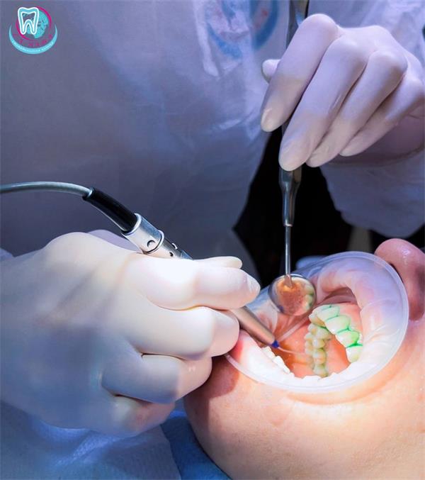 пародонтальный карман